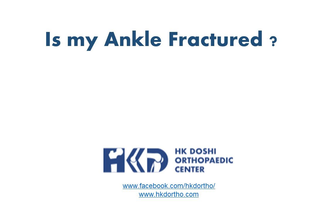 Ankle Fracture