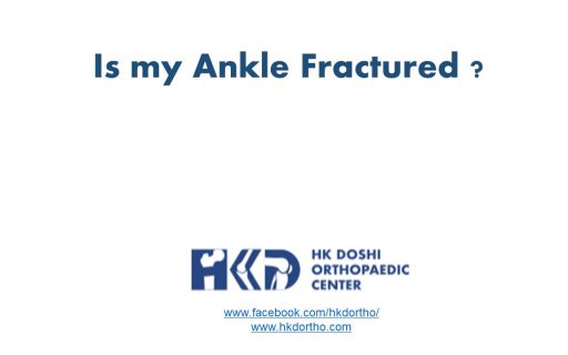 Ankle Fracture